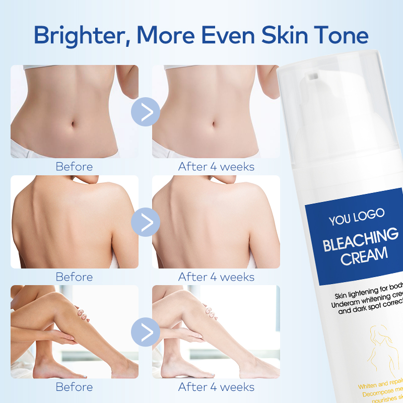Wholesale Skin Lightening Cream for Intimate Areas Vitamin C Dark Spot Remover for Underarms, Knees, Elbows Bikini Line(pic2)
