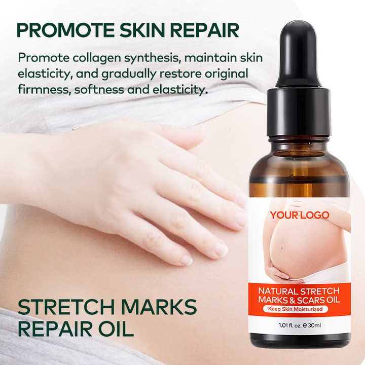 Private Label Natural Marks & Scars Repair Skin Nourishing Smoothing Message Oil Natural Stretch Mark Oil
