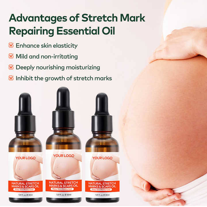 Private Label Natural Marks & Scars Repair Skin Nourishing Smoothing Message Oil Natural Stretch Mark Oil