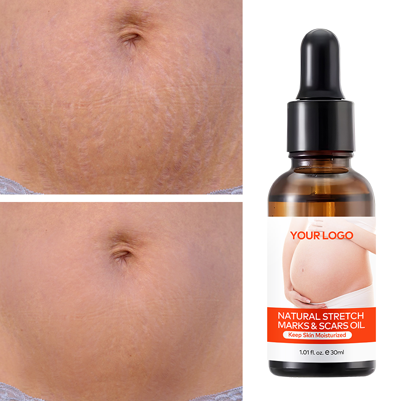 Private Label Natural Marks & Scars Repair Skin Nourishing Smoothing Message Oil Natural Stretch Mark Oil(pic4)