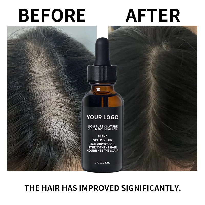 Wholesale Rosemary Oil for Hair Growth With Batana Hair Strengthening Oil for All Hair Types