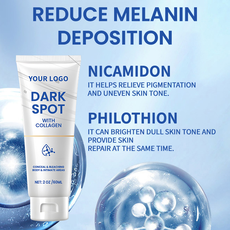 AgeSpots Sun Spots Freckles Melasma Brown Spots, Use on Face Hands Underarms and Legs, Dark Spot Remover for Face and Body Cream