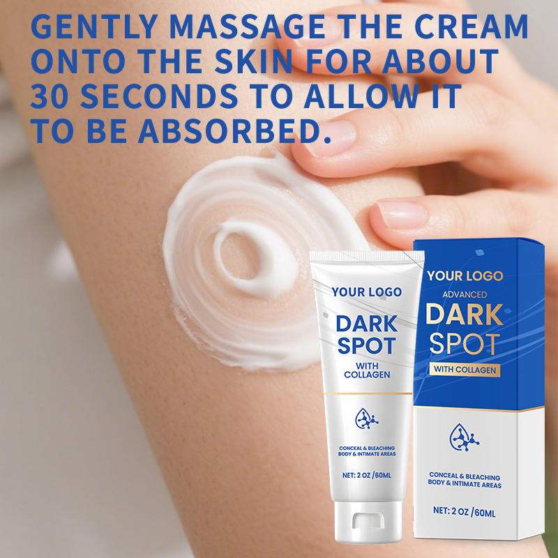 AgeSpots Sun Spots Freckles Melasma Brown Spots, Use on Face Hands Underarms and Legs, Dark Spot Remover for Face and Body Cream