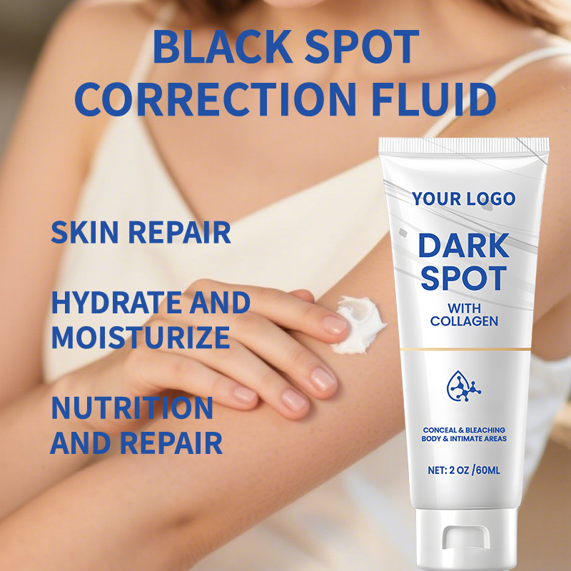 AgeSpots Sun Spots Freckles Melasma Brown Spots, Use on Face Hands Underarms and Legs, Dark Spot Remover for Face and Body Cream