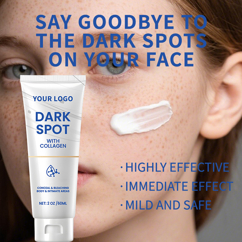 AgeSpots Sun Spots Freckles Melasma Brown Spots, Use on Face Hands Underarms and Legs, Dark Spot Remover for Face and Body Cream