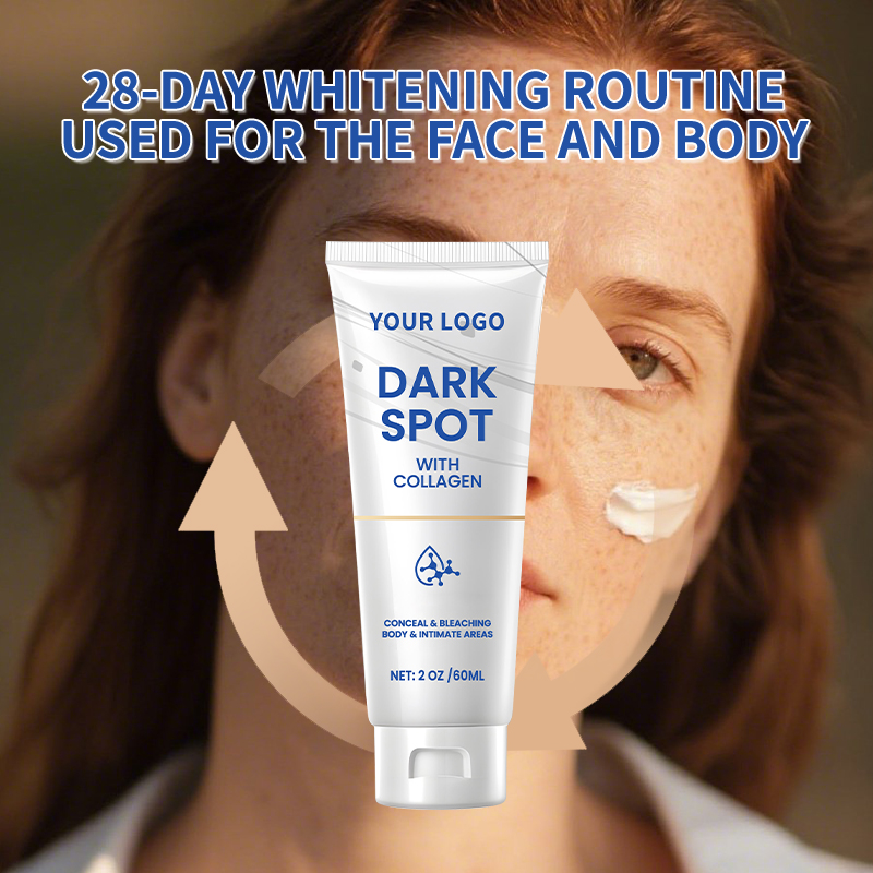 AgeSpots Sun Spots Freckles Melasma Brown Spots, Use on Face Hands Underarms and Legs, Dark Spot Remover for Face and Body Cream