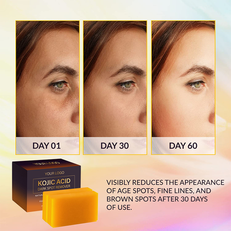 OEM ODM Private Label Plant Grow Kojic Acid Dark Spot Remover Soap Bars with VC Shea Butter Castile Olive Oil