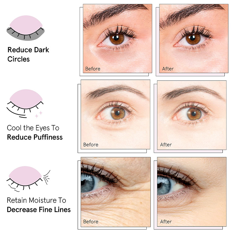 Wholesale Under Eye Mask for Dark Circles, Puffy Eyes, Under Eye Bags, Wrinkles Gel Eye Patches(pic2)