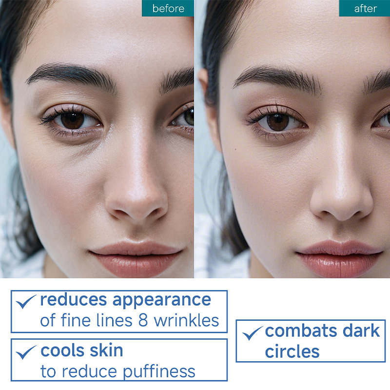 OEM Anti-Aging Eye Cream with Retinol and Hyaluronic Acid Wholesale Available