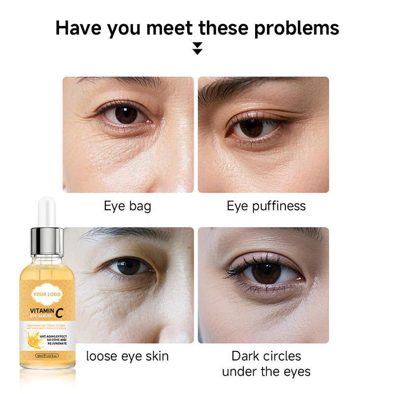 Private Label Natural Vc Eye Serum for Dark Circles, Fine Lines Puffiness Crow'S Feet Eye Bags Under Eyes