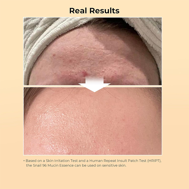 Private Label Korean Beauty Snail Mucin 96% Power Face Serum Mucin Serumessence Facial Whitening Repair Snail Serum