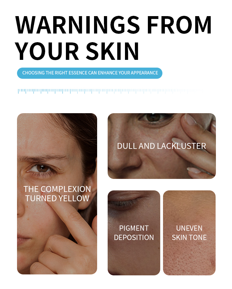 Custom B3 Niacinamide 10% Brightening Serum for Face, Anti-Aging Whitening Essence