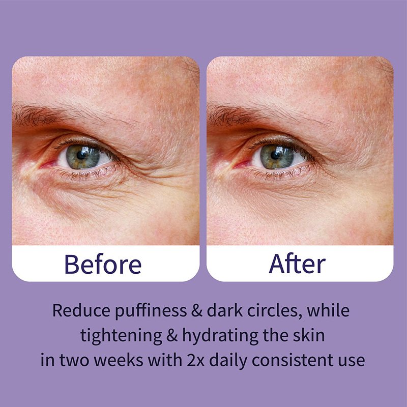 Peptide Eye Essence & Bag Removal Wrinkle Repair Firming Moisturizer