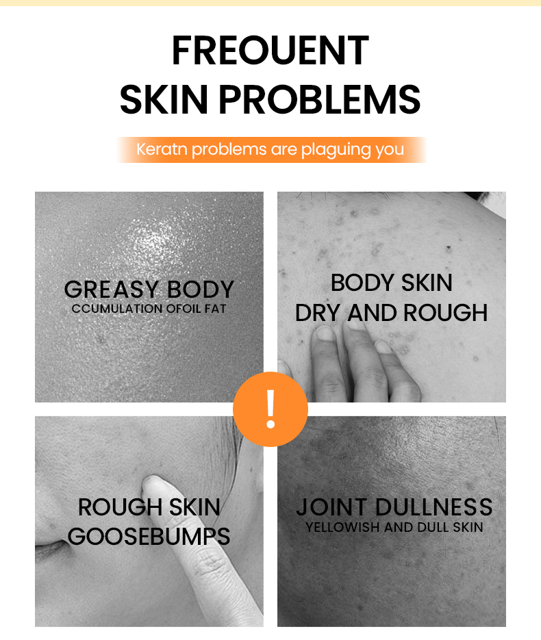 Herbal Natural Turmeric Soap Bar Face Body Brightening Acne Treatment Reduces Dark Spots Oil Control Gentle Cleansing All Skin(pic2)