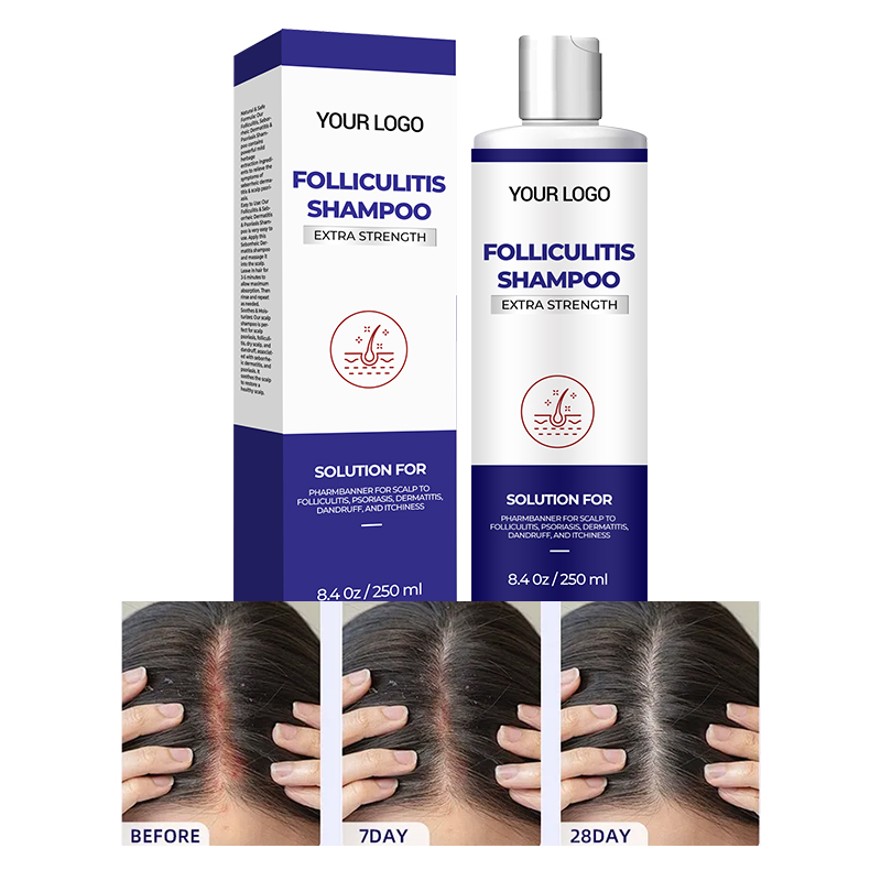 Organic Anti-Loss Biotin Hair Shampoo Nourishing Refreshing Formula Hair-Loss Prevention