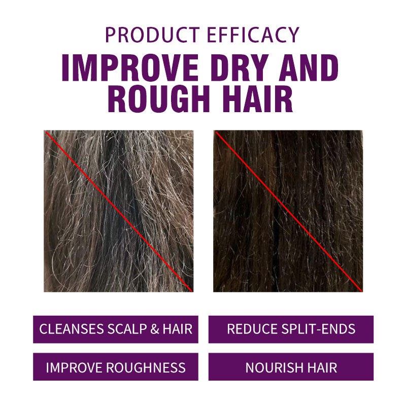 Agan Essential Oil Smooth Shampoo, Anti-Dandruff and Hair Loss Treatment Shampoo, Hair Conditioner, Skin Care Oil, Hair Mask(pic2) Agan Essential Oil Smooth Shampoo, Anti-Dandruff and Hair Loss Treatment Shampoo, Hair Conditioner, Skin Care Oil, Hair Mask(pic2)