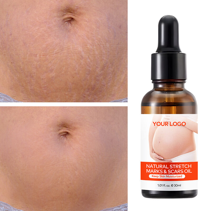 Wholesale Organic Postpartum Belly Texture Repair Skin Lubrication and Moisturizing Scar Healing Essential Oil(pic5) Wholesale Organic Postpartum Belly Texture Repair Skin Lubrication and Moisturizing Scar Healing Essential Oil(pic5)