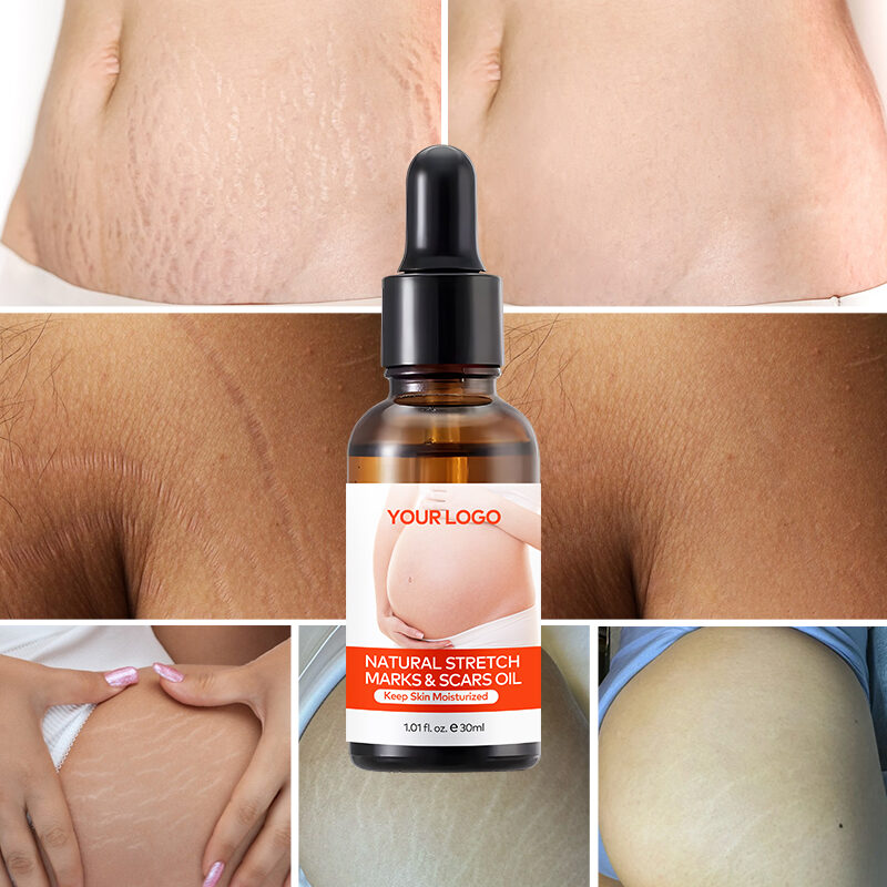 Wholesale Organic Postpartum Belly Texture Repair Skin Lubrication and Moisturizing Scar Healing Essential Oil(pic6) Wholesale Organic Postpartum Belly Texture Repair Skin Lubrication and Moisturizing Scar Healing Essential Oil(pic6)