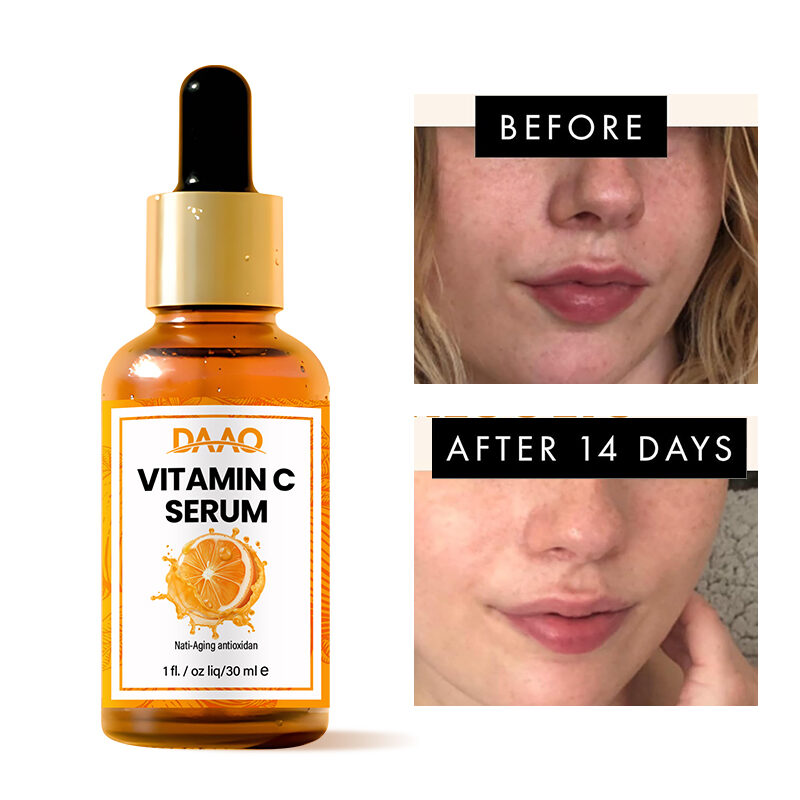 Wholesale Age Repair Essence Dark Spot Removal Brightening Vitamin C Serum With Hyaluronic Acid(pic3) Wholesale Age Repair Essence Dark Spot Removal Brightening Vitamin C Serum With Hyaluronic Acid(pic3)