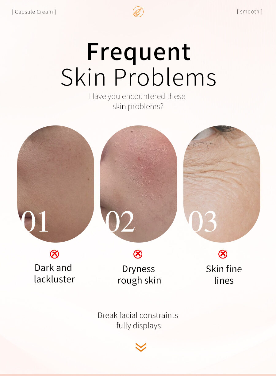 Greenlem Astaxanthin Improve Rough and Dull SkinCapsule Cream(pic1) Greenlem Astaxanthin Improve Rough and Dull SkinCapsule Cream(pic1)
