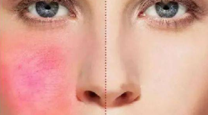 DAAO cosmetics OEM:Spring is the season when allergies are most common. How to distinguish real allergies from fake ones?(pic2) image.png