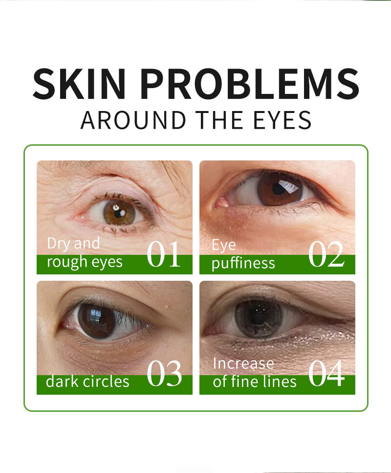 Private Label Anti-Wrinkle Eye Mask Caffeine & Hyaluronic Acid Revitalize Swollen Dark Circle Under Eye Mask OEM(pic2)